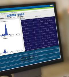 美林醫療動態心電分析系統