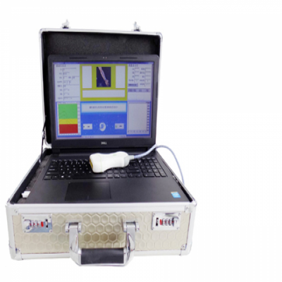 超聲及X射線(xiàn)骨密度儀分體便攜升級(jí)版