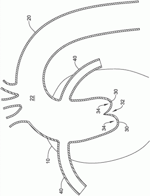 經導管主動脈瓣膜系統(tǒng)EVOLUTPRO-23-US