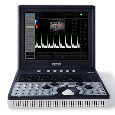 d3便攜式全數字彩色多普勒超聲診斷系統(tǒng)