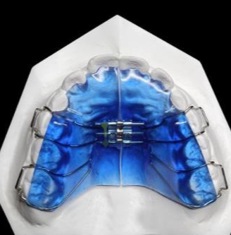 華偉定制式矯治器擴弓型、矯治保持型、牙膠片型