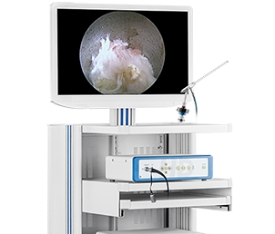 冠龍醫(yī)用內窺鏡攝像系統(tǒng)ys-iii