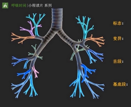 支氣管ct影像處理軟件