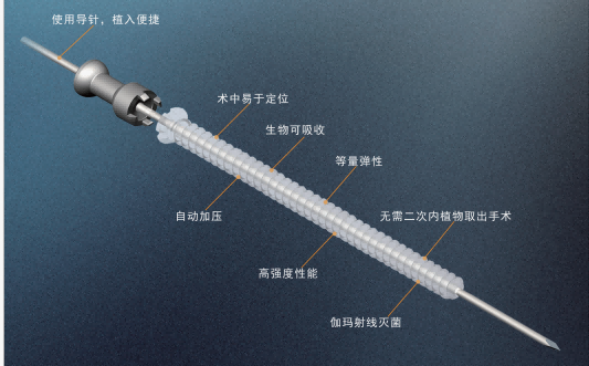 dj可吸收骨接合植入物4.0